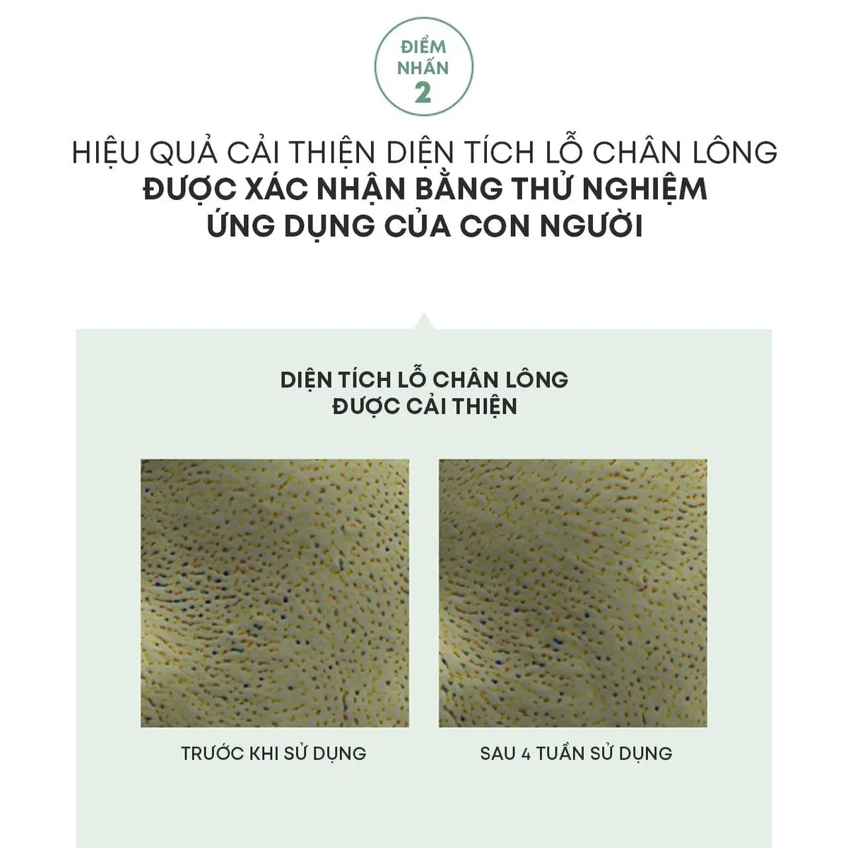 tinh-chat-the-face-shop-tea-tree-pore-ampoule-30ml-9