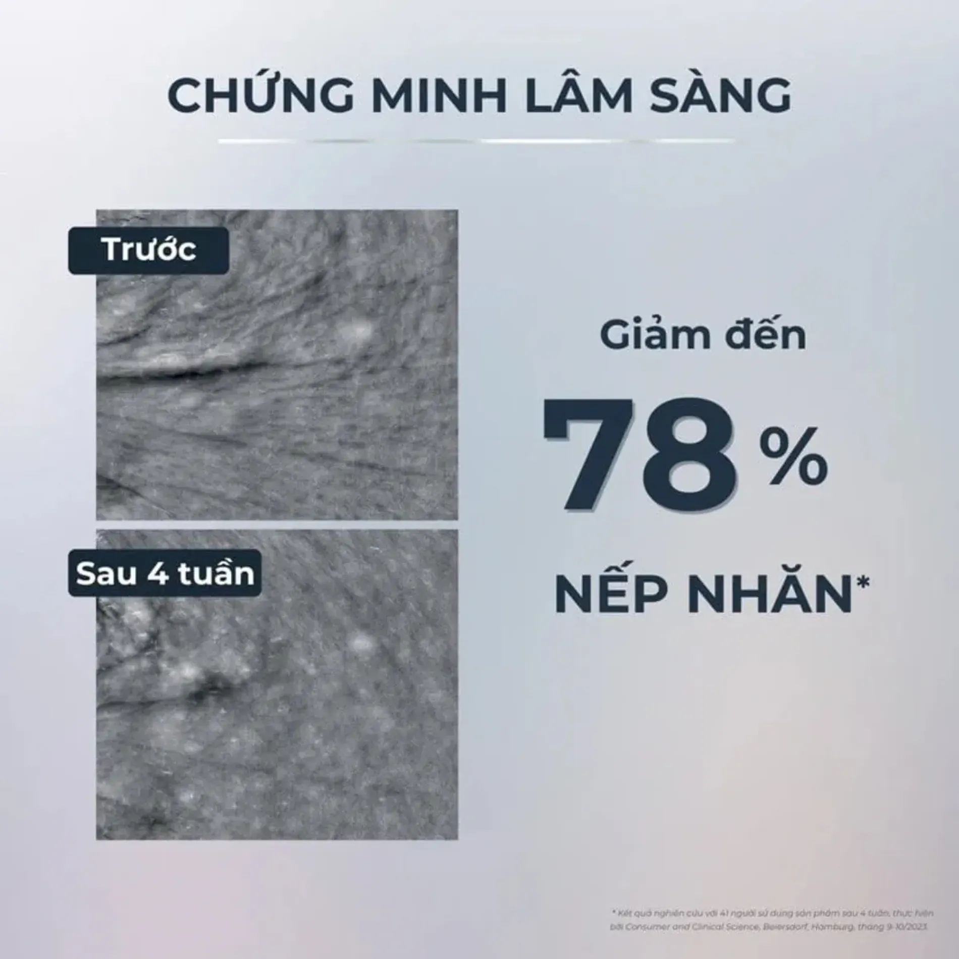 tinh-chat-eucerin-cai-thien-lao-hoa-da-hyaluron-filler-epicelline-serum-30ml-3