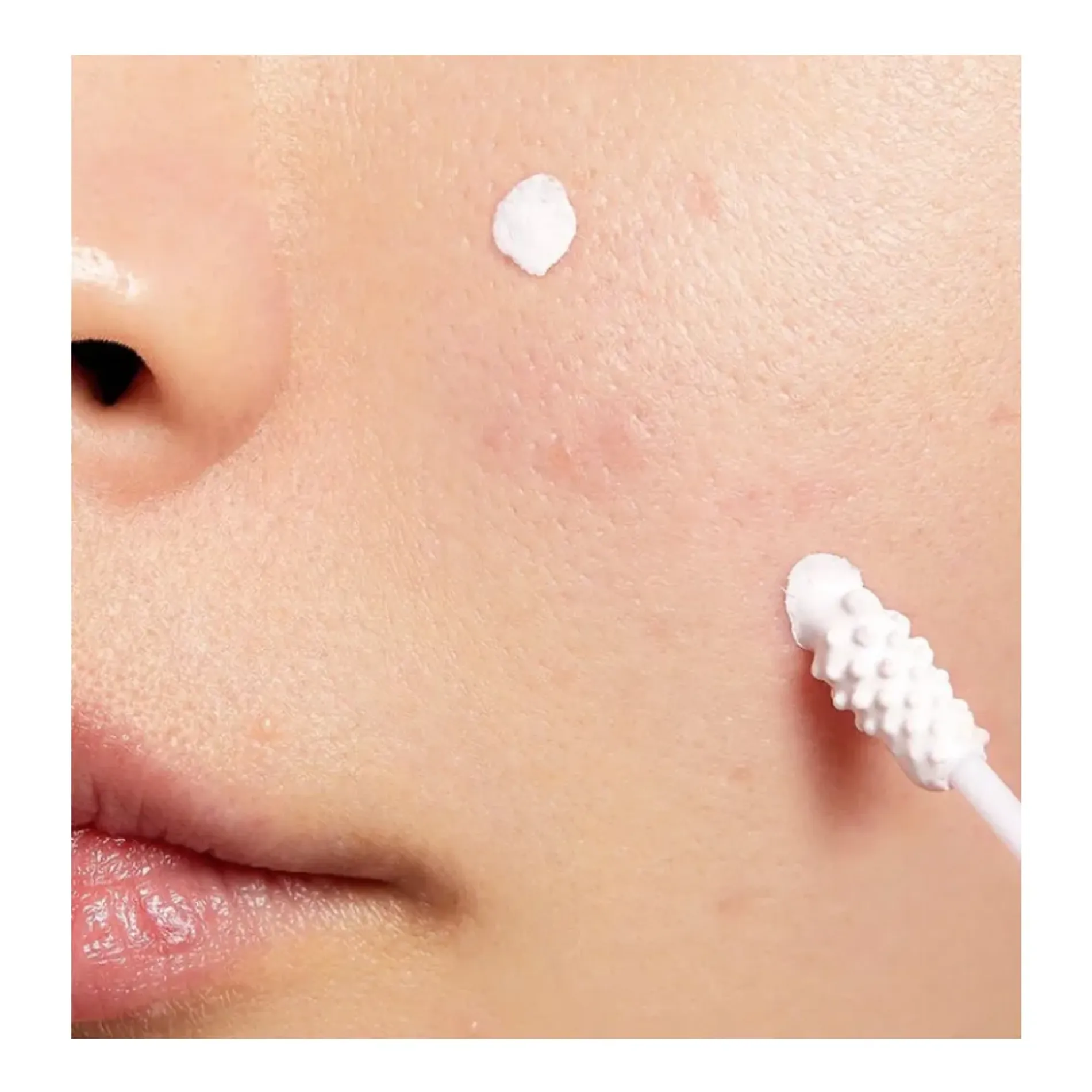 tinh-chat-cham-mun-cosrx-ac-collection-blemish-spot-drying-lotion-30ml-3