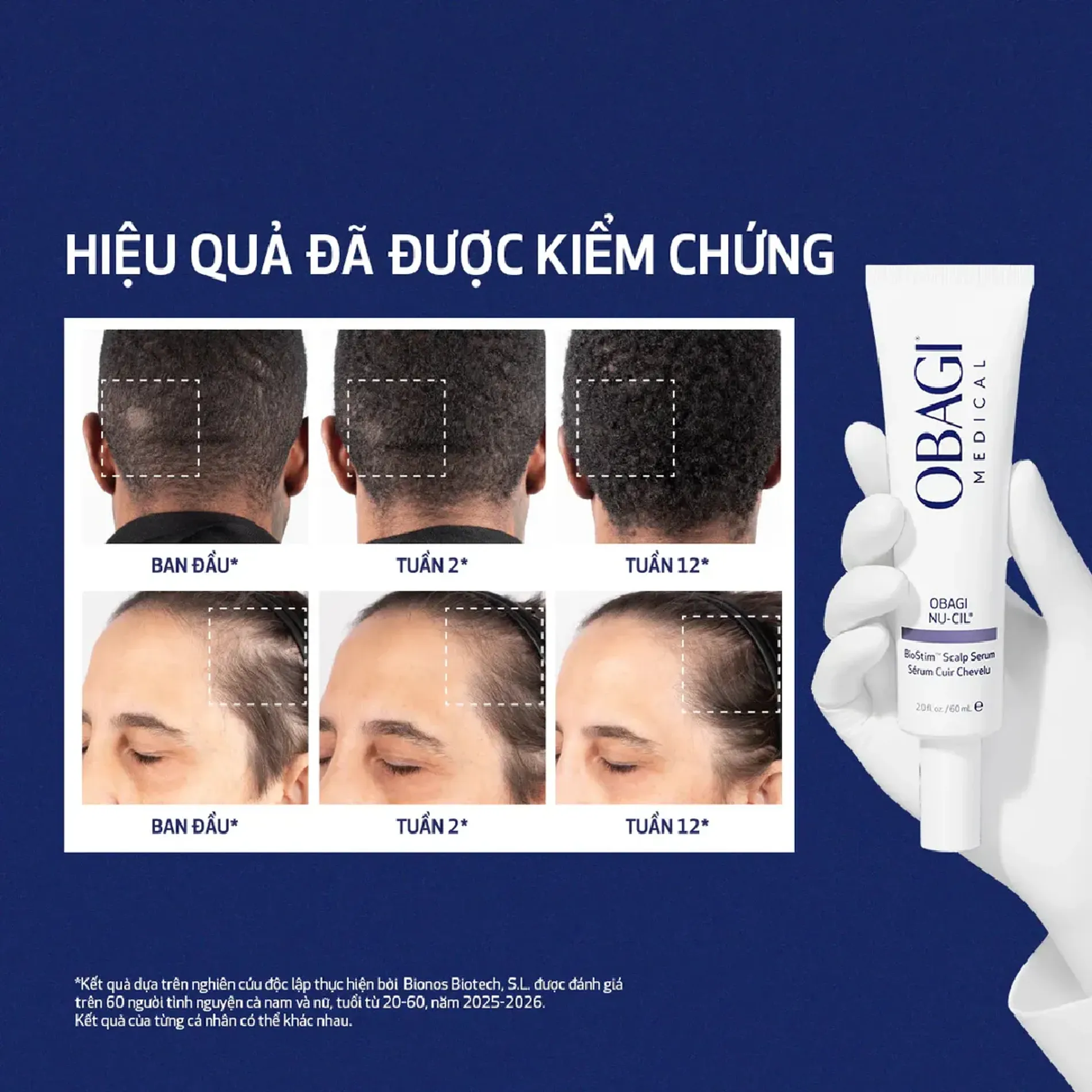 tinh-chat-obagi-nu-cil-biostim-scalp-serum-50ml-7