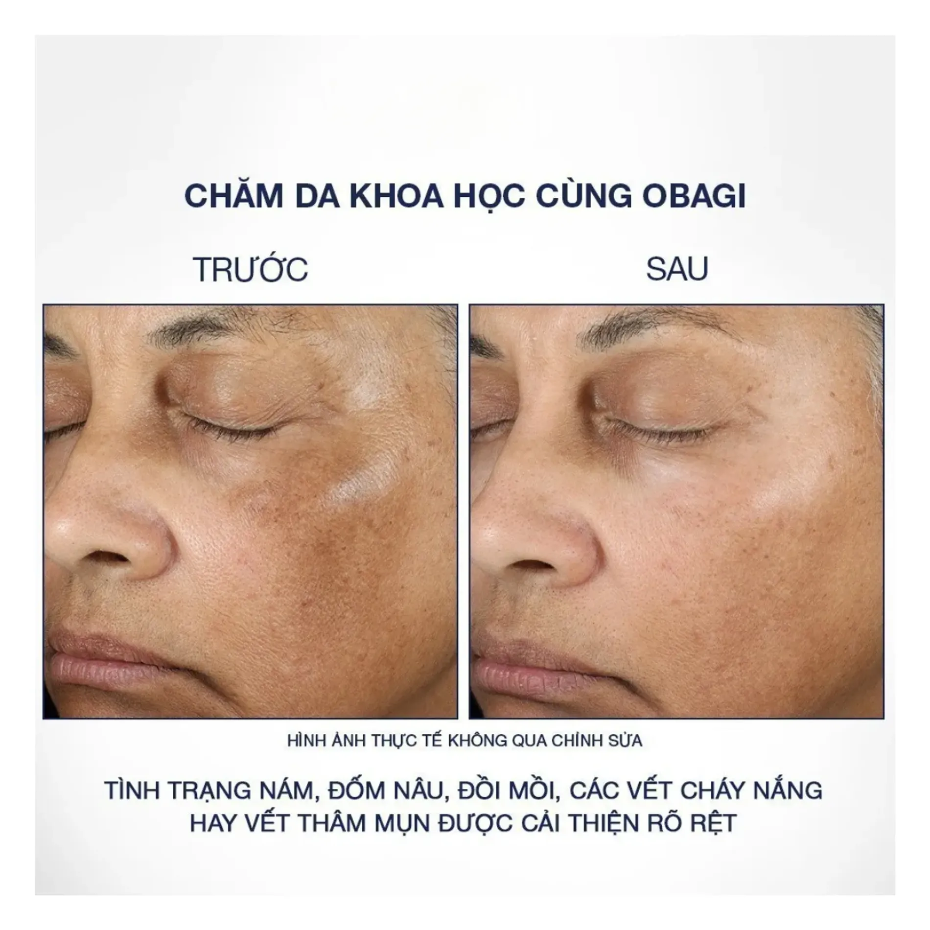 kem-duong-obagi-sang-da-mo-nam-nu-derm-blend-fx-57g-4