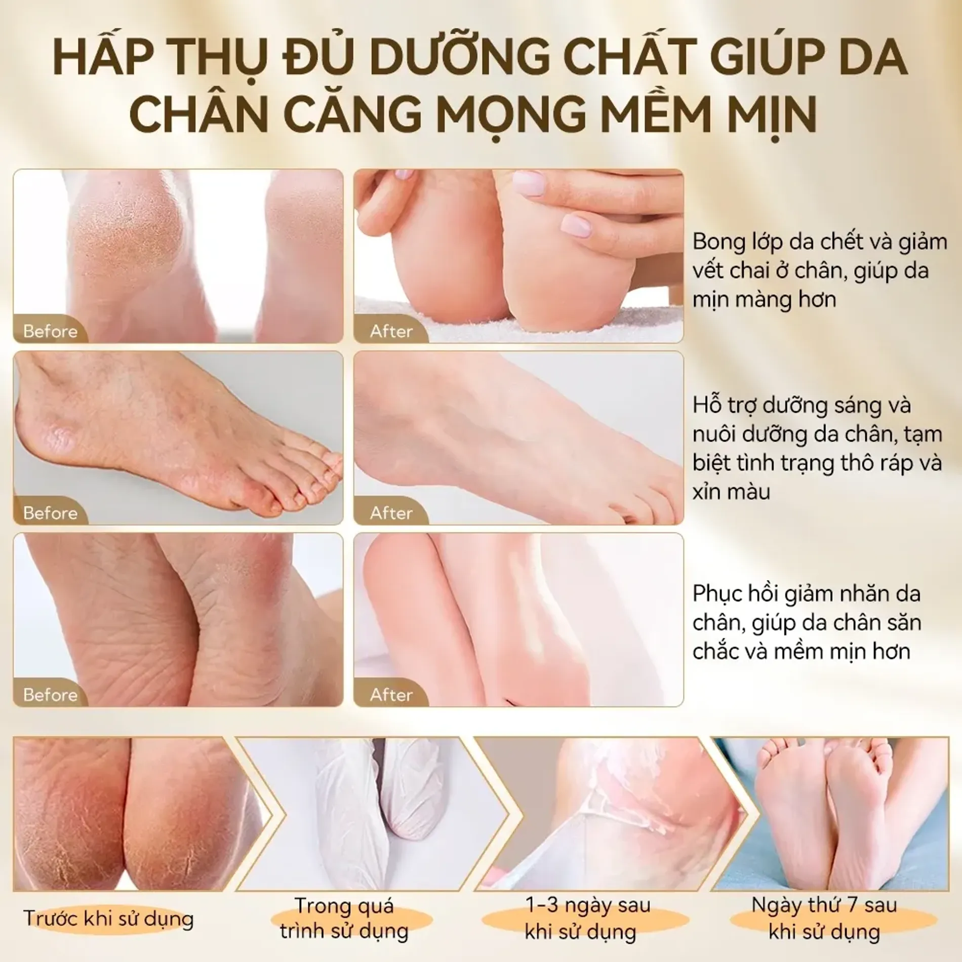 mat-na-chan-lanbena-ho-tro-lam-sach-da-chet-coffee-foot-peel-mask-5