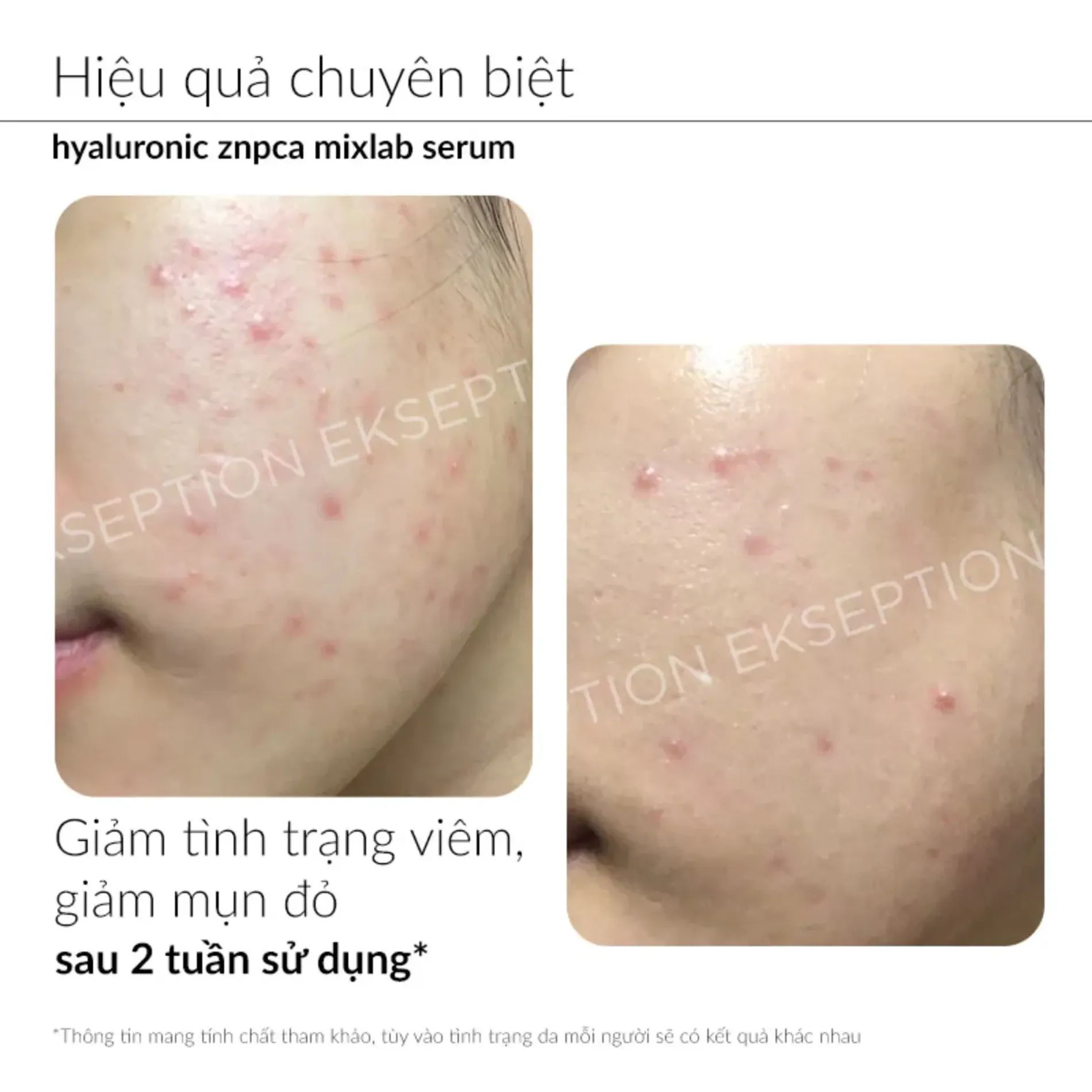 ekseption-hyaluronic-znpca-mixlab-serum-75ml-6