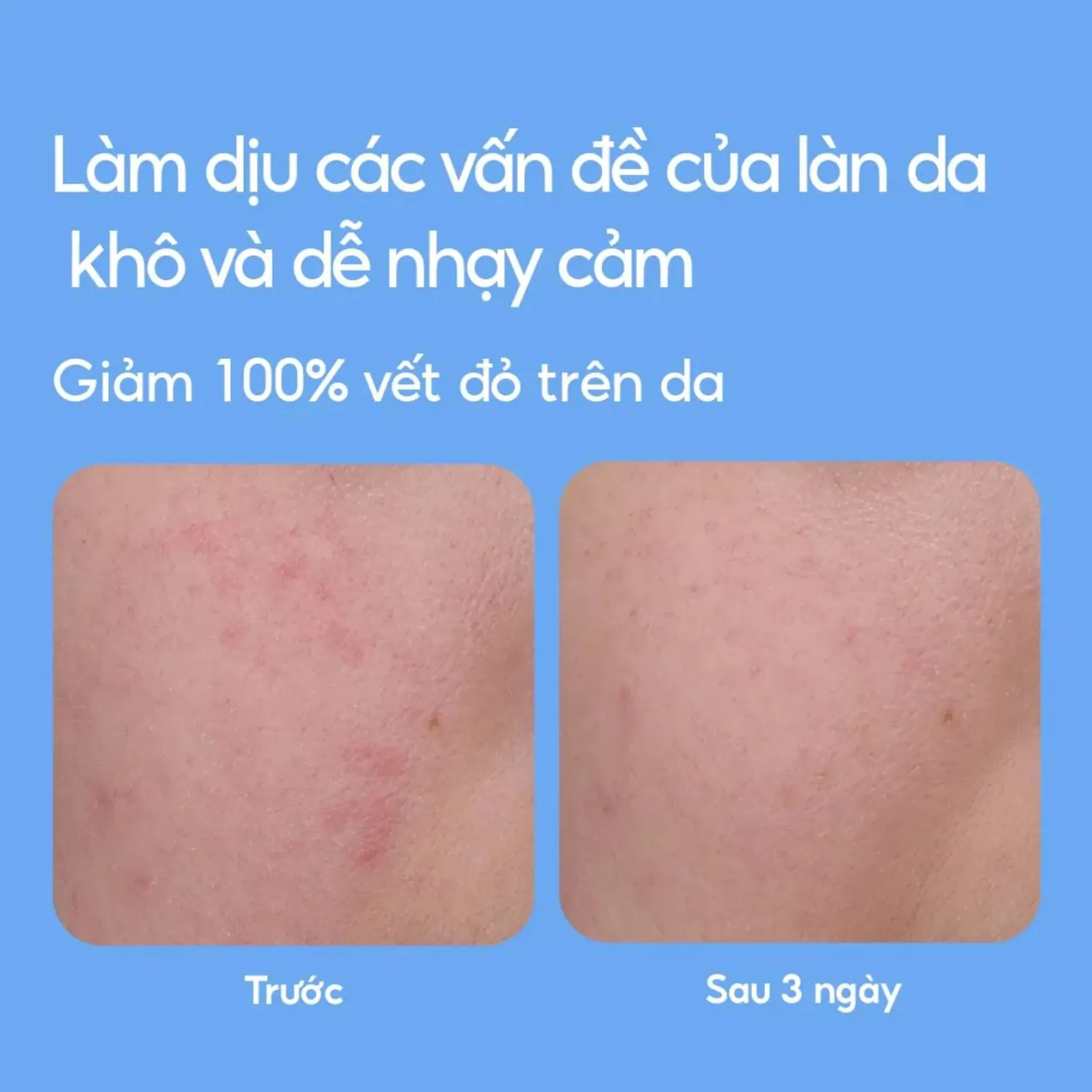 phien-ban-moi-2024-kem-duong-laneige-cap-am-cho-da-mem-mai-water-bank-blue-hyaluronic-gel-cream-50ml-10