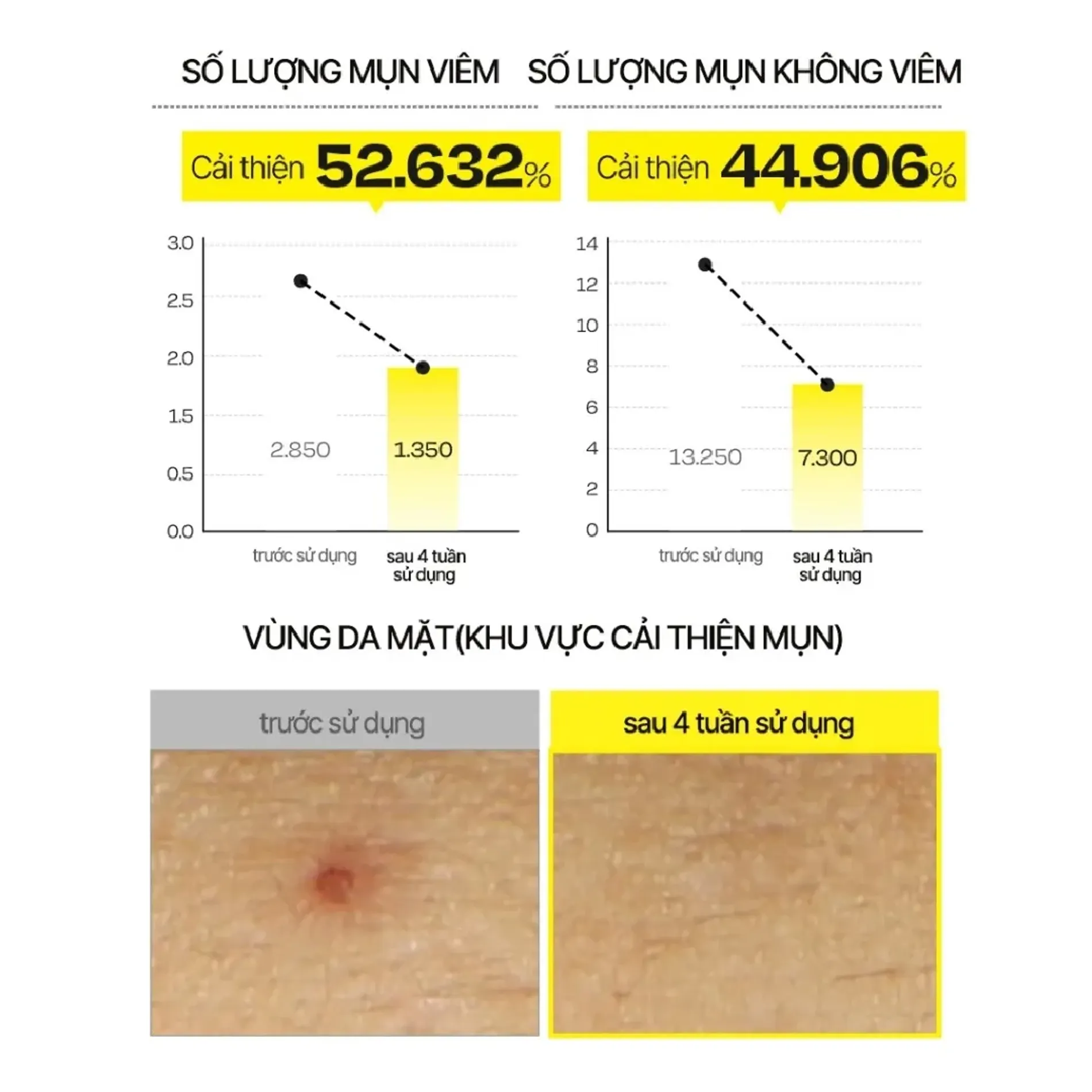 serum-dalba-white-truffle-first-spray-100ml-5
