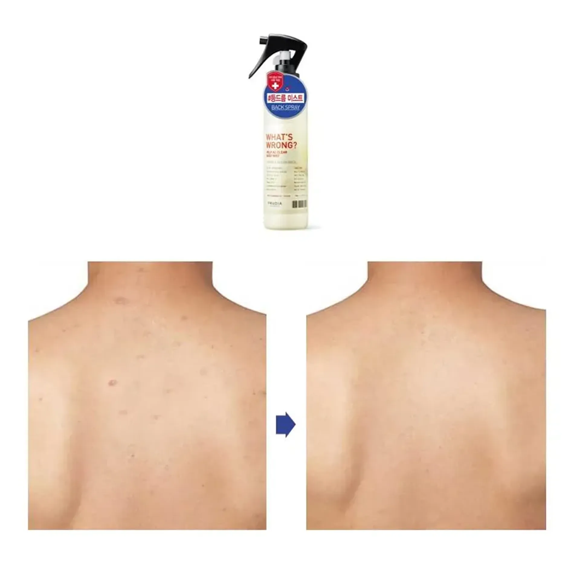 xit-khoang-ngua-mun-lung-frudia-whats-wrong-help-ac-clear-body-mist-150ml-6