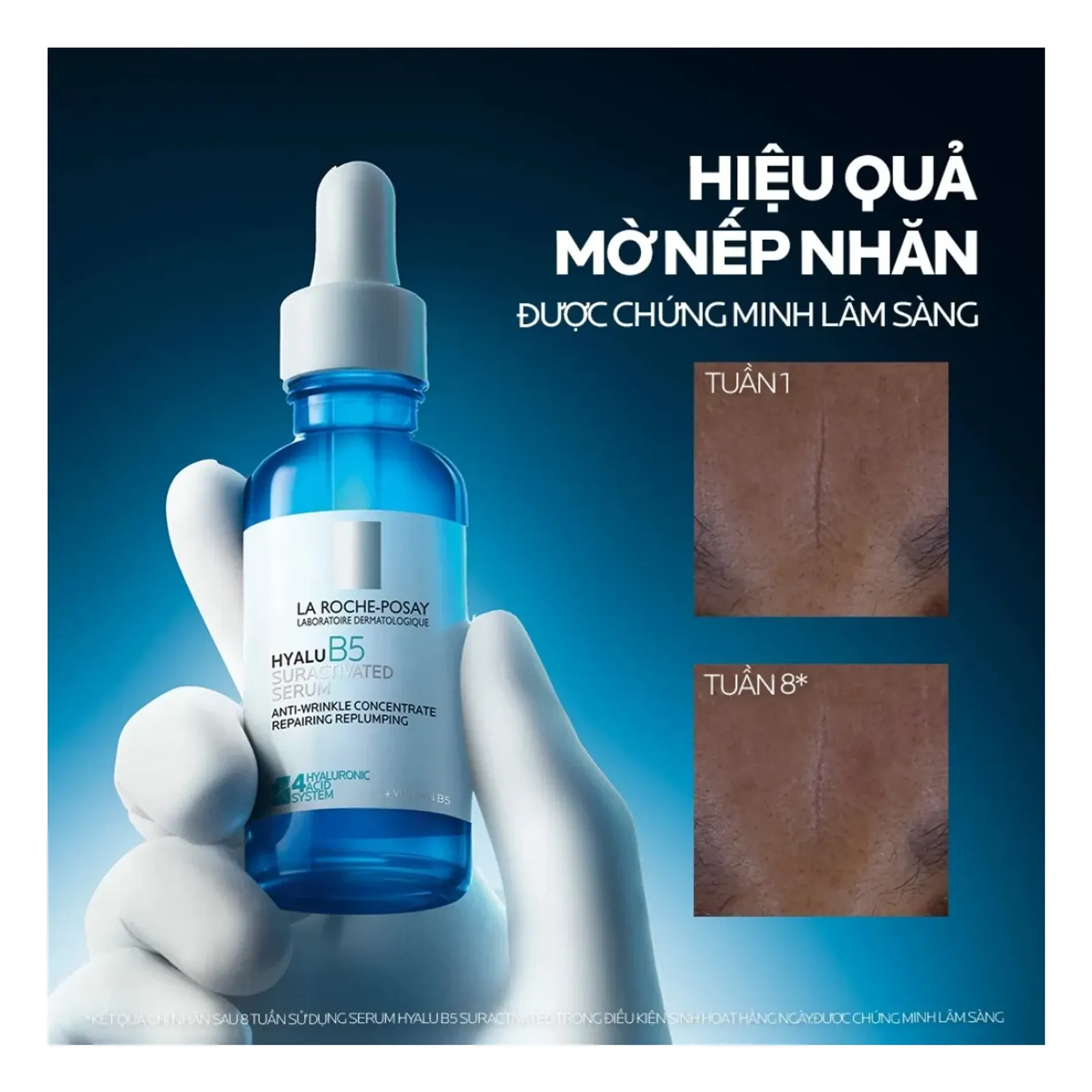 tinh-chat-duong-am-mo-nep-nhan-la-roche-posay-hyalu-b5-suractivated-serum-30ml-4