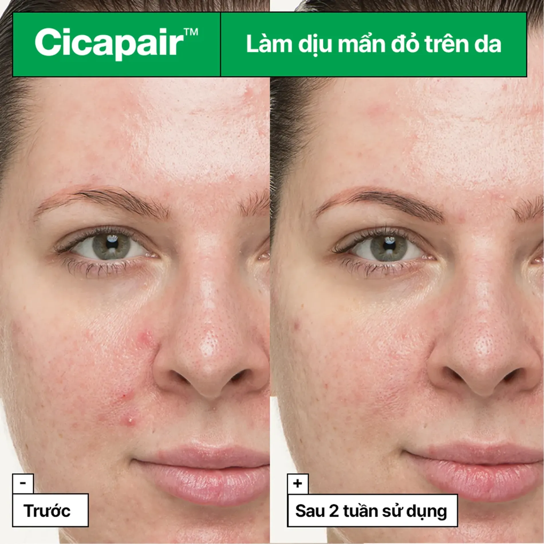 kem-duong-lam-diu-va-phuc-hoi-da-drjart-cicapair-so-soothing-treatment-30ml-6