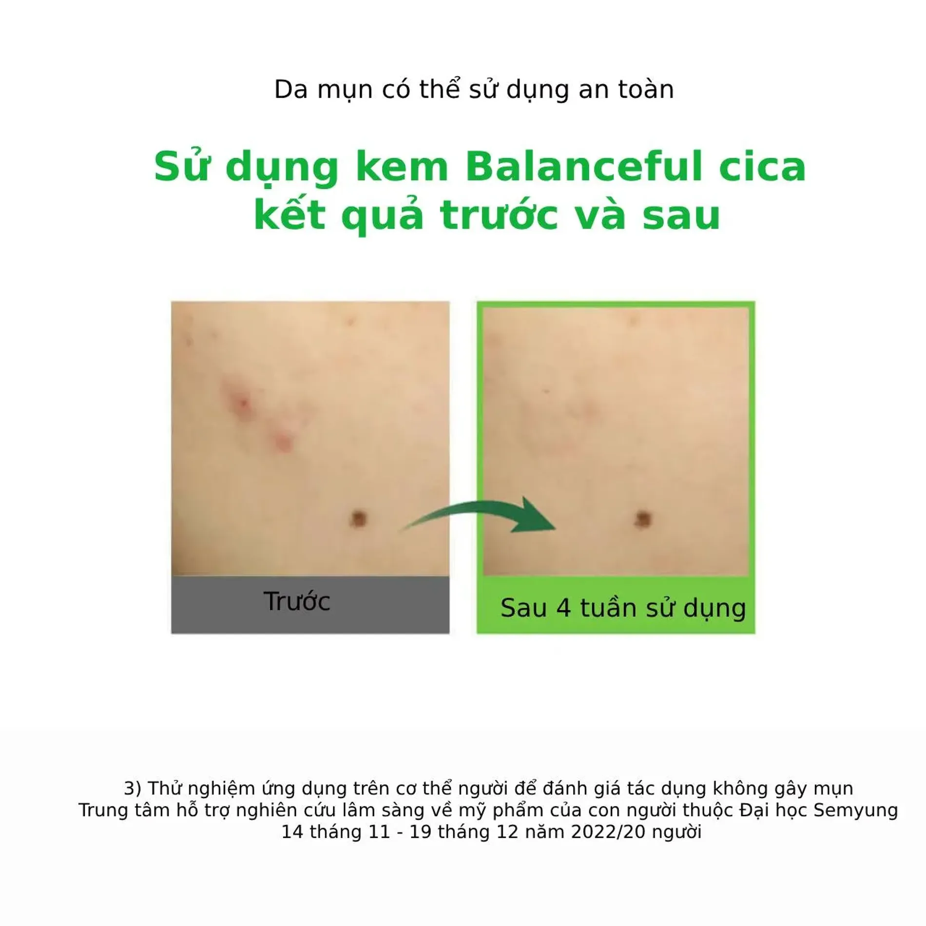 kem-duong-torriden-phuc-hoi-da-mem-mai-balanceful-cica-cream-80ml-2
