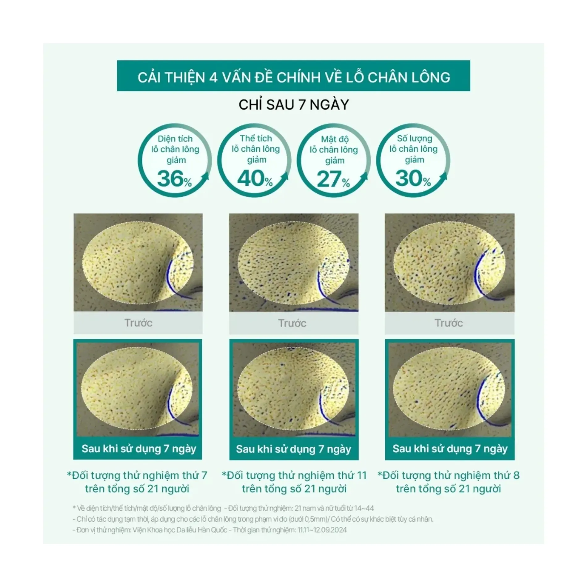 tinh-chat-tram-tra-thuan-chay-beyond-angel-teatreeol-10-ampoule-50ml-7