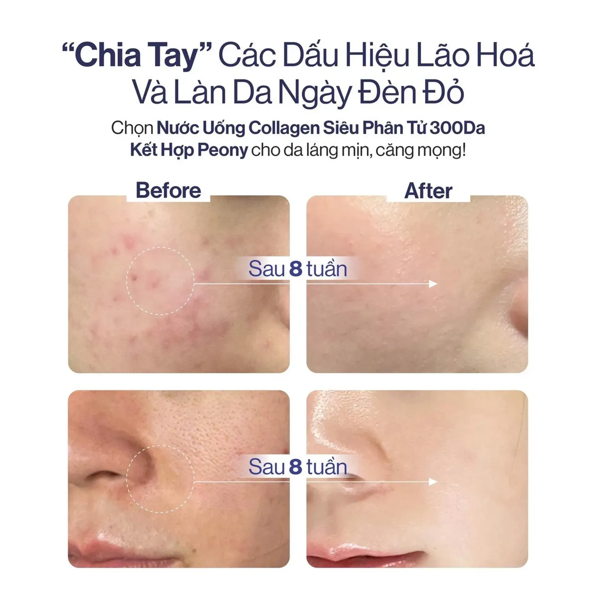 collagen-gilaa-bright-peony-7