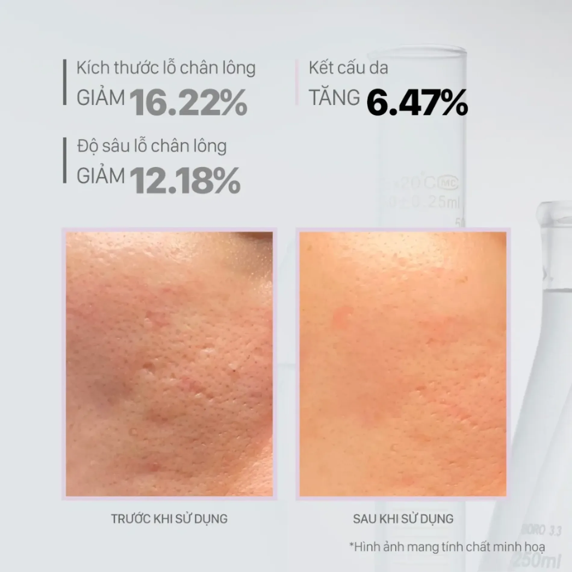 tinh-chat-thu-nho-lo-chan-long-cnp-derma-answer-anti-pore-peel-ampule-aha-6