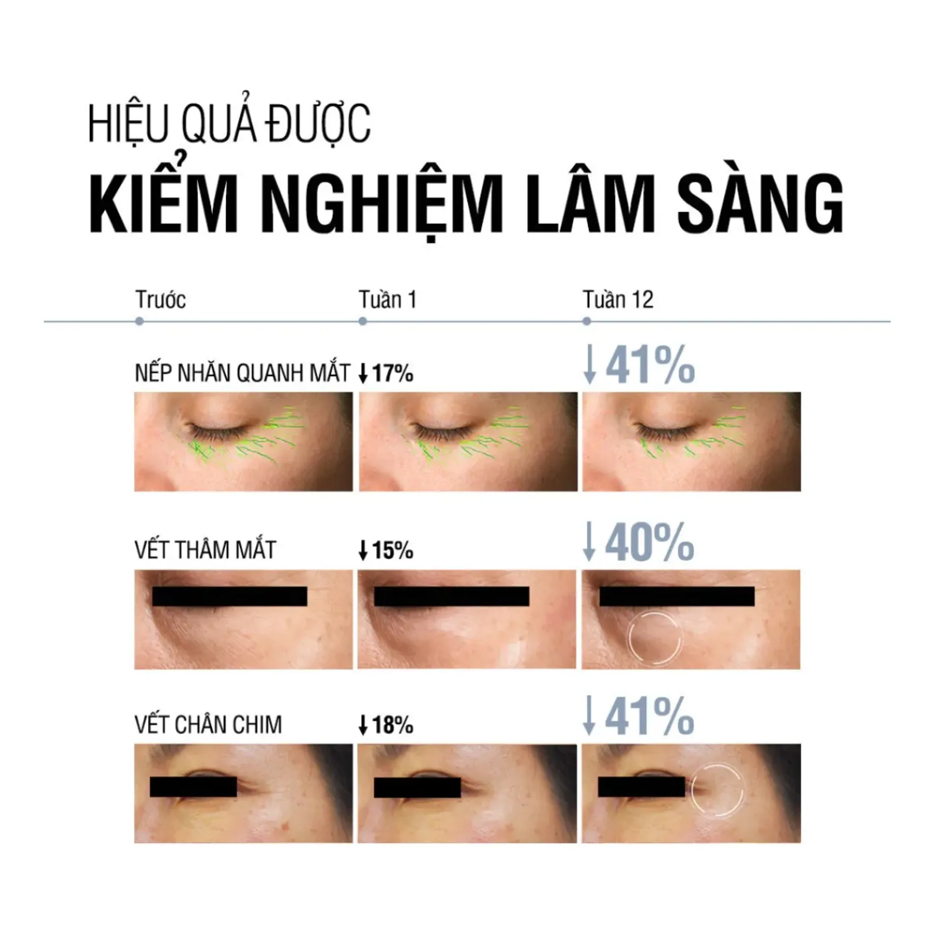 kem-mat-neutrogena-giam-nhan-tre-hoa-da-visible-repair-eye-cream-15g-4