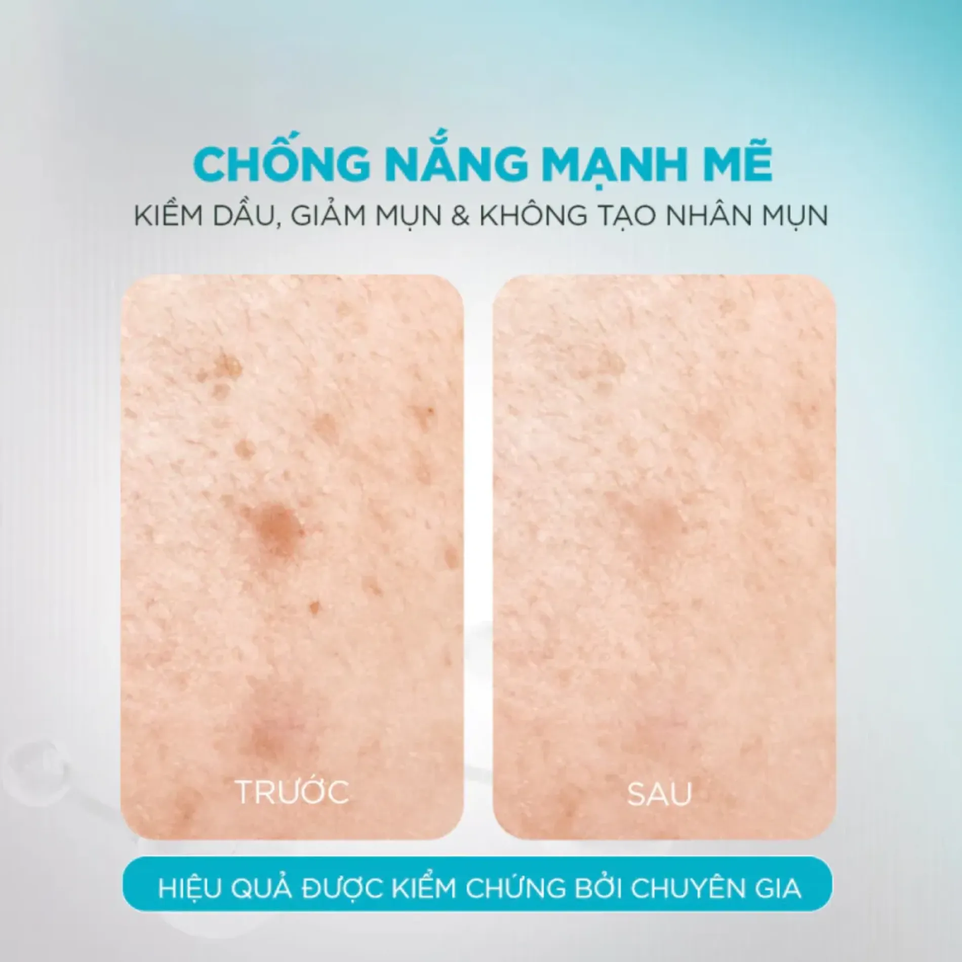 kem-chong-nang-cho-da-dau-mun-garnier-super-uv-anti-acnes-serum-spf-50pa-30ml-4