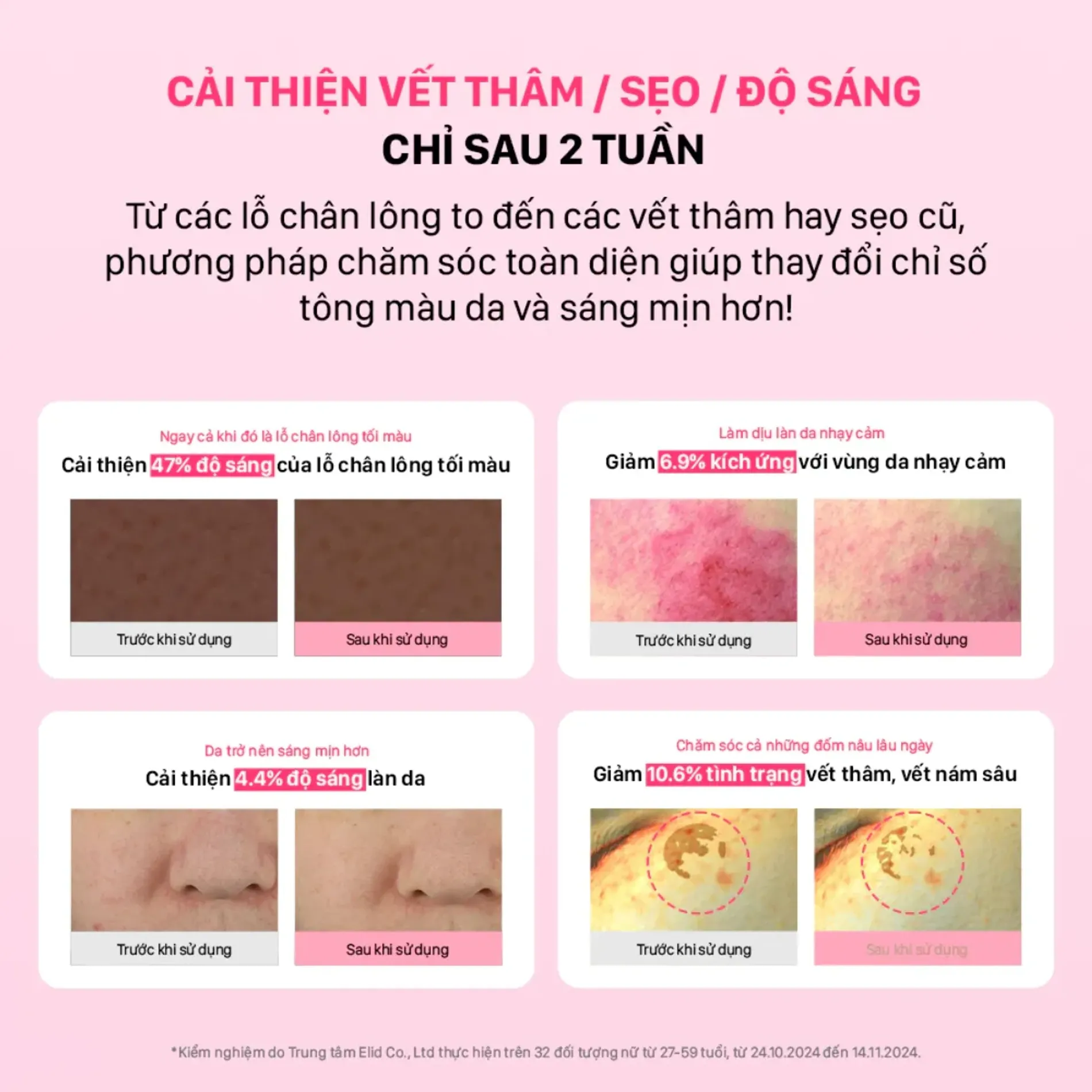 tinh-chat-vi-kim-duong-sang-hong-da-cnp-derma-answer-pink-toning-deepin-shot-ampoule-6