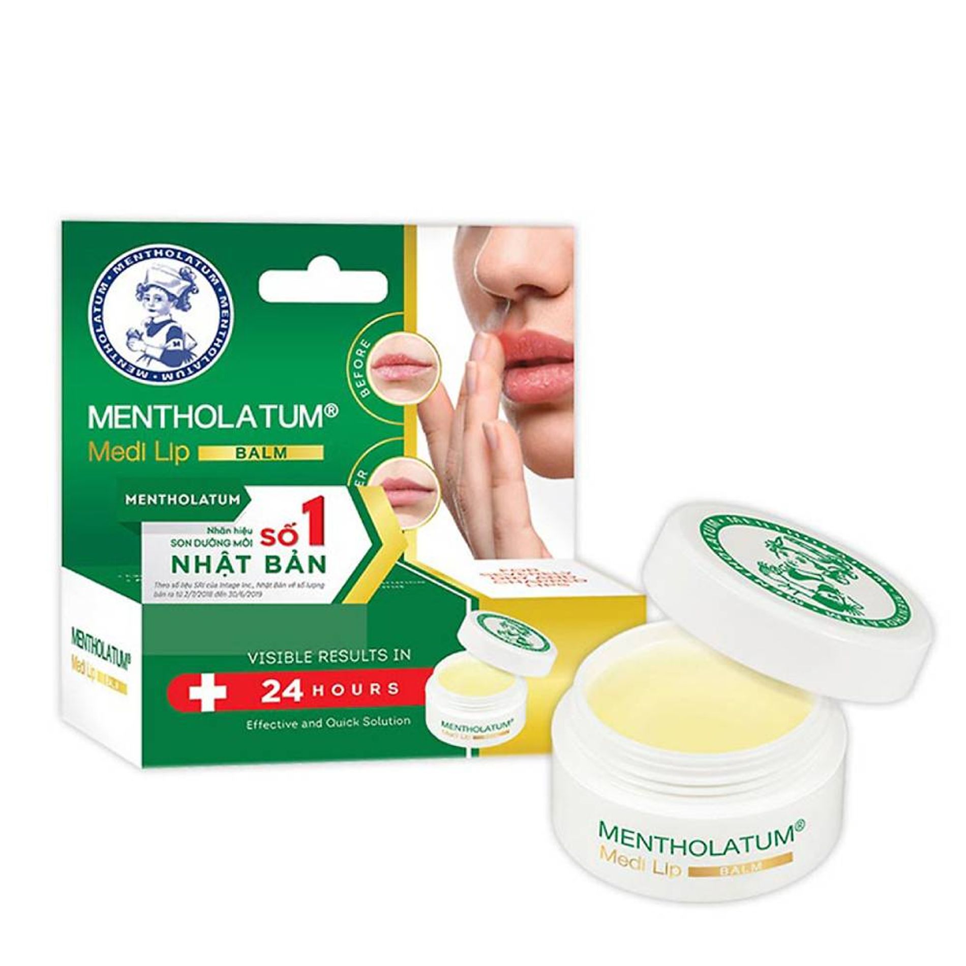 son-duong-moi-dang-balm-mentholatum-medi-lip-balm-7g-4