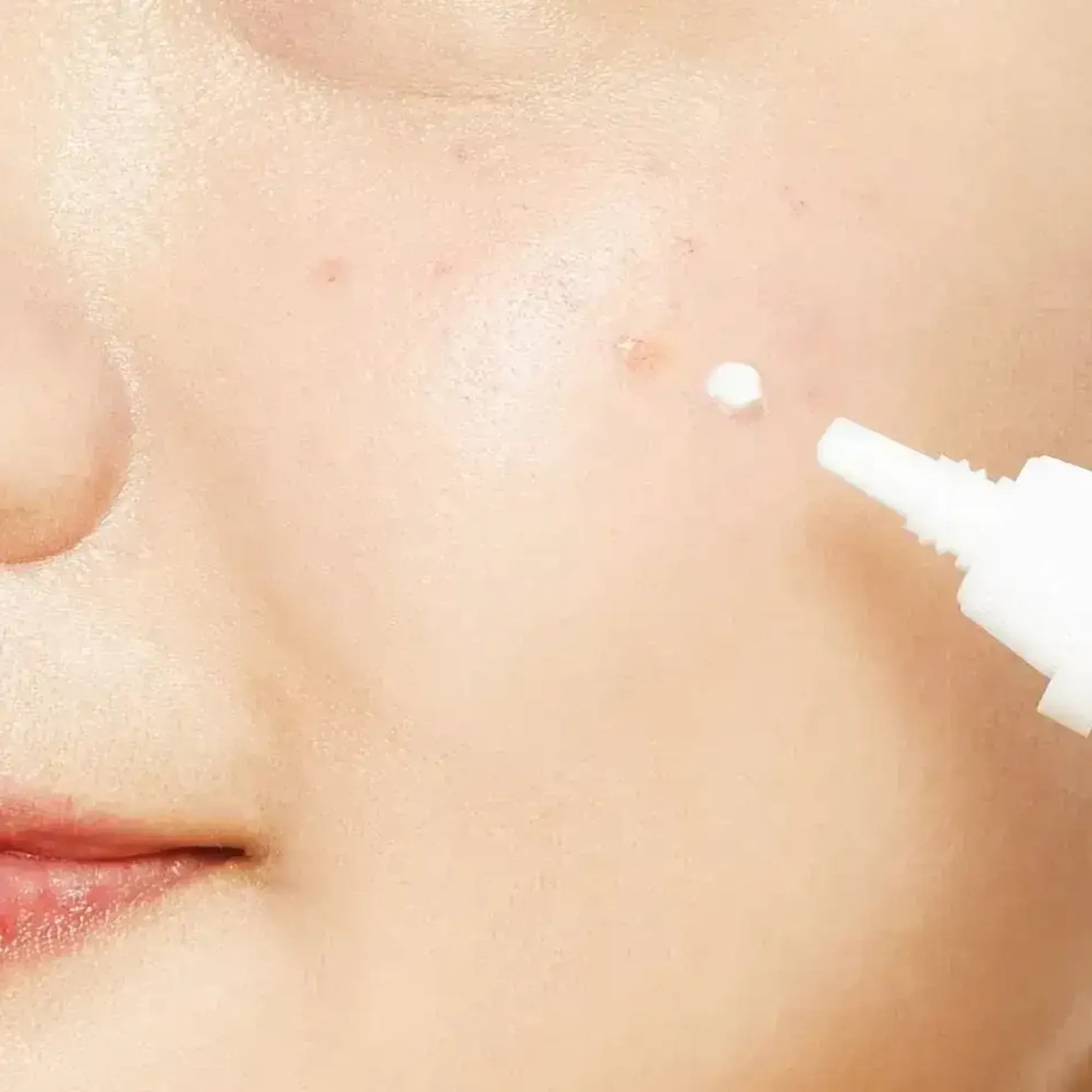 kem-duong-da-mat-cosrx-ac-collection-ultimate-spot-cream-2