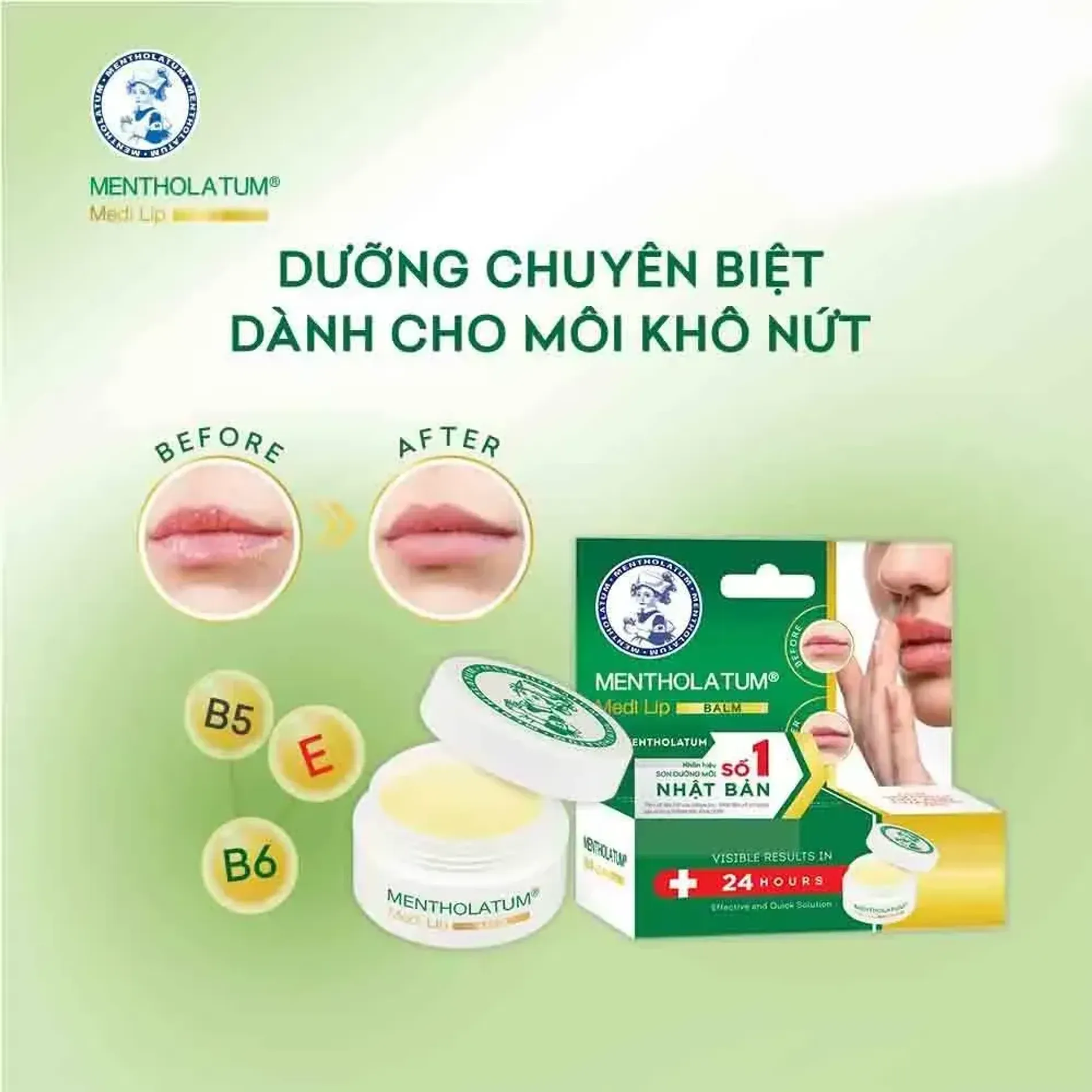 son-duong-moi-dang-balm-mentholatum-medi-lip-balm-7g-2