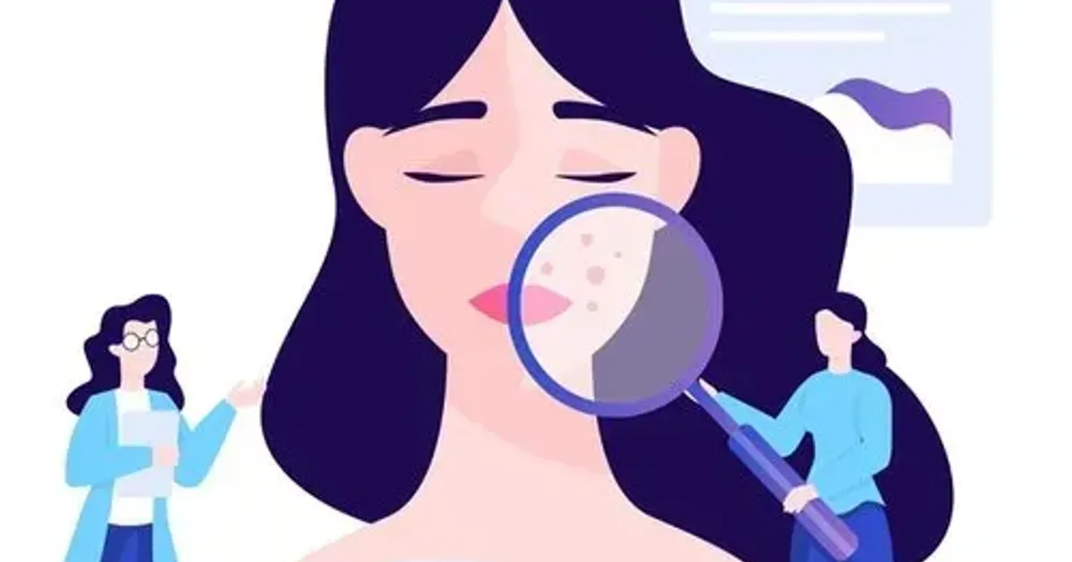Cách phân biệt da nhạy cảm và da bị dị ứng - The Face Shop Chính Hãng