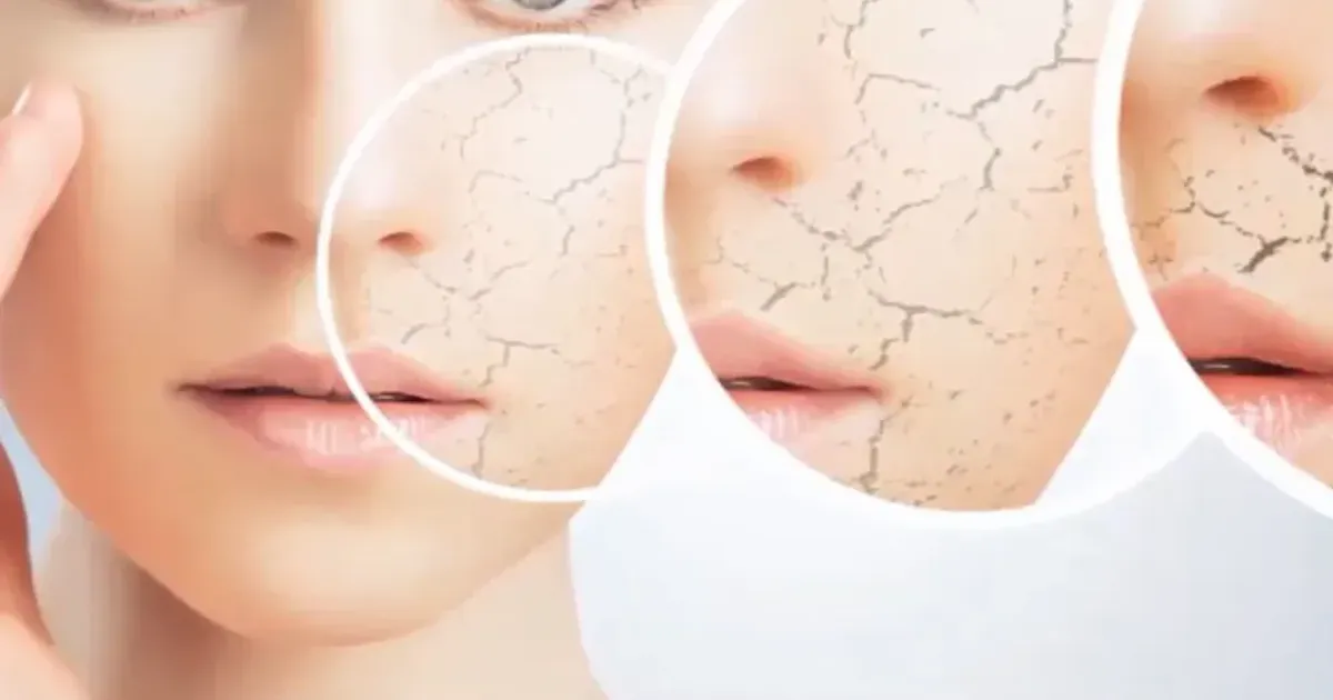 Đánh giá top 5 kem dưỡng ẩm cho da khô tốt nhất - The Face Shop Chính Hãng