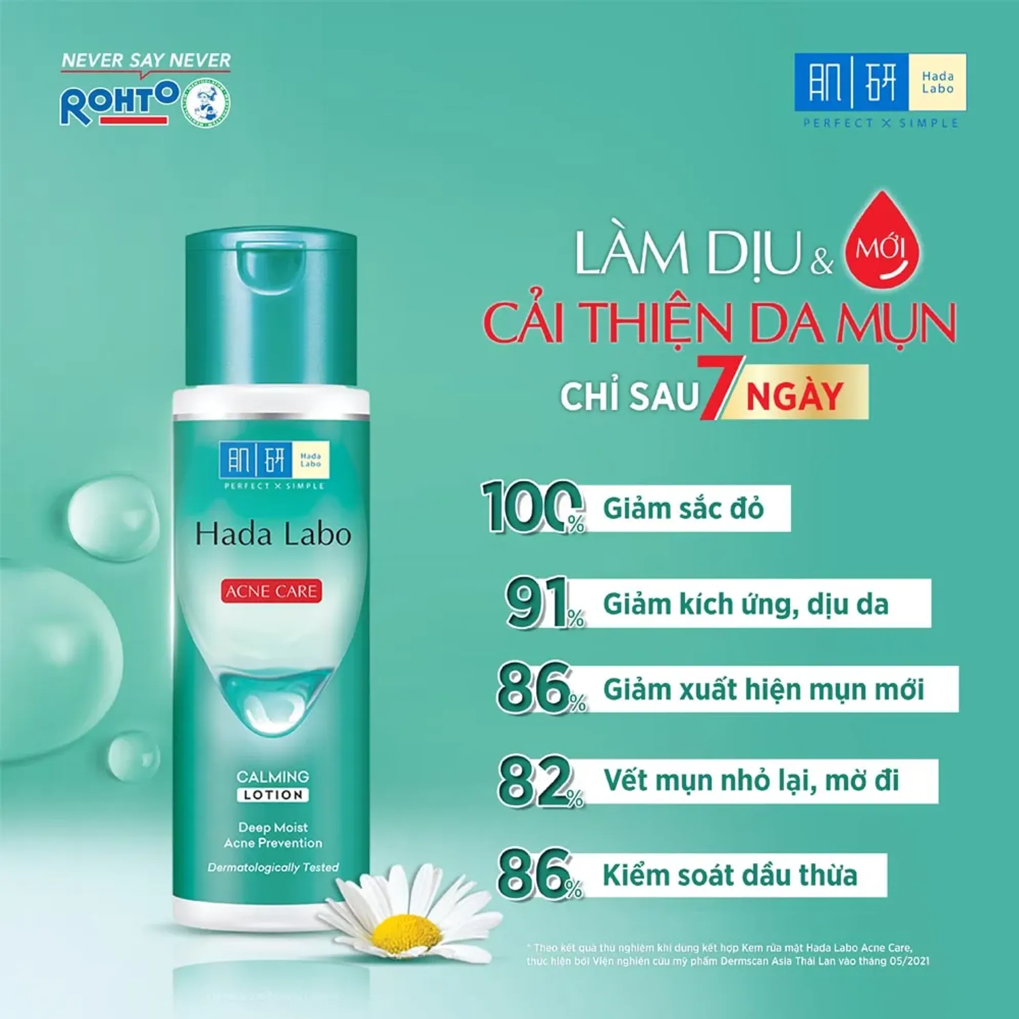 Dung Dịch Dưỡng Ẩm & Ngừa Mụn Hada Labo Acne Care Calming Lotion 170Ml