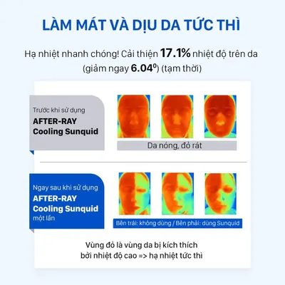 sua-chong-nang-lam-diu-da-cnp-after-ray-cooling-sunquid-50ml-3