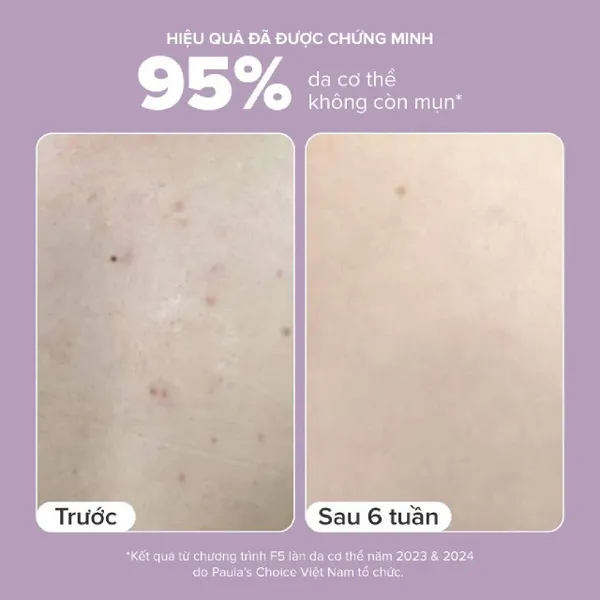 kem-duong-the-paulas-choice-bha-body-smoothing-spot-10