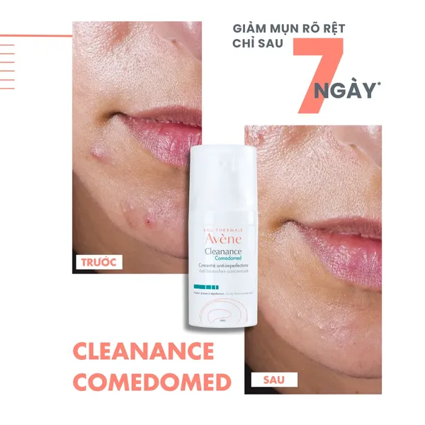 tinh-chat-avene-giam-mun-hieu-qua-cleanance-comedomed-concentrate-30ml-4