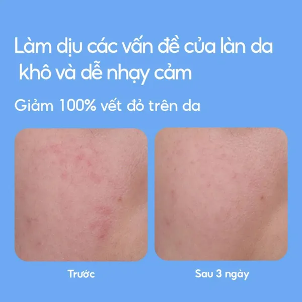 phien-ban-moi-2024-kem-duong-laneige-cap-am-cho-da-mem-mai-water-bank-blue-hyaluronic-gel-cream-50ml-10