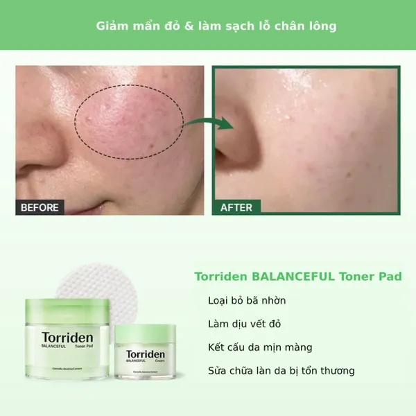 toner-pad-torriden-lam-diu-cap-am-da-balanceful-cica-toner-pad-60-mieng-10