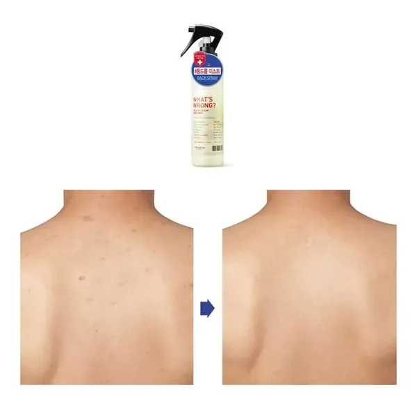 xit-khoang-ngua-mun-lung-frudia-whats-wrong-help-ac-clear-body-mist-150ml-6