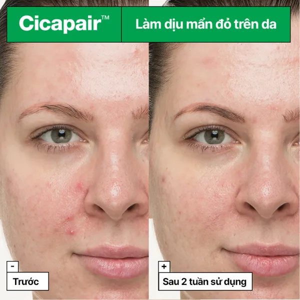 kem-duong-lam-diu-va-phuc-hoi-da-drjart-cicapair-so-soothing-treatment-30ml-6