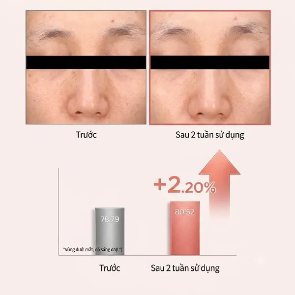 mat-na-mat-giam-nep-nhan-dermatory-pro-vita-a-retinal-eye-patch-60pcs-7