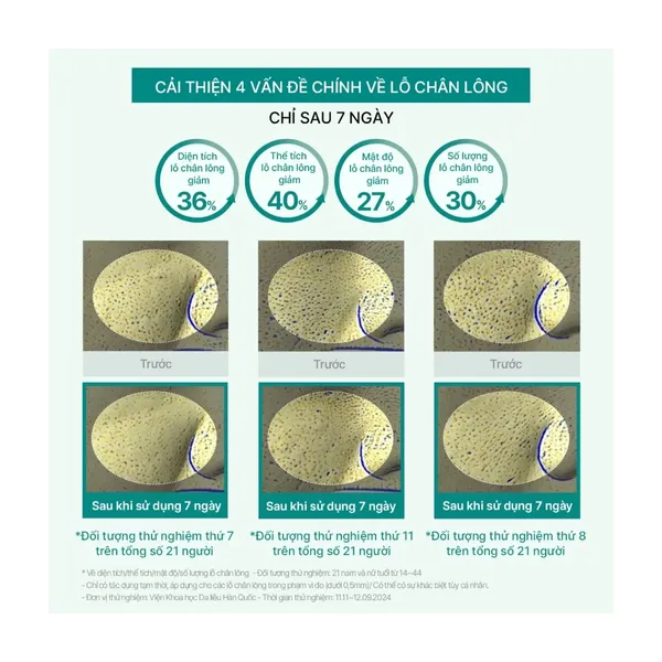 tinh-chat-tram-tra-thuan-chay-beyond-angel-teatreeol-10-ampoule-50ml-7