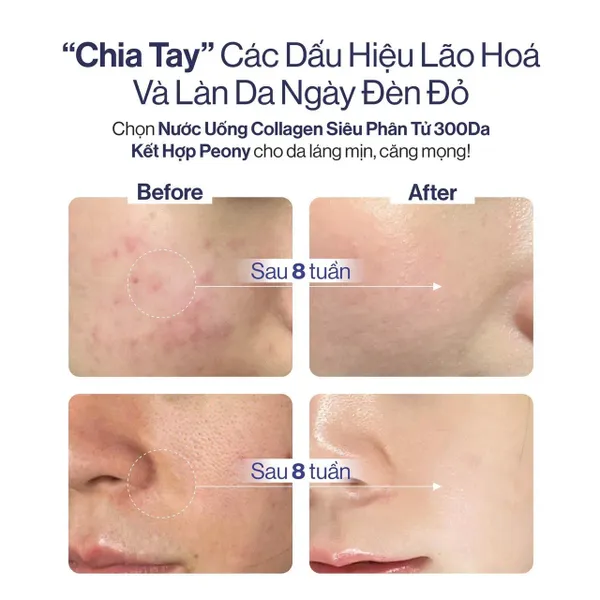 collagen-gilaa-bright-peony-7