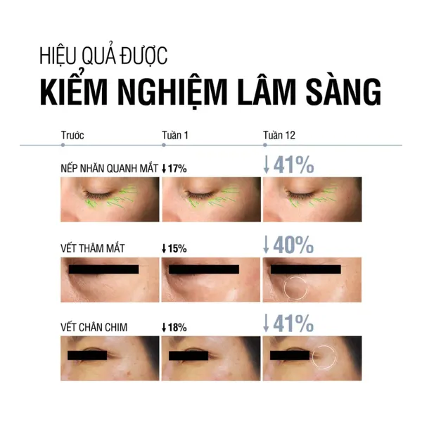 kem-mat-neutrogena-giam-nhan-tre-hoa-da-visible-repair-eye-cream-15g-4