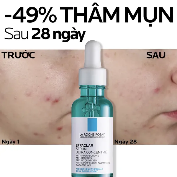 tinh-chat-giam-mun-giam-tham-thu-nho-lo-chan-la-roche-posay-effaclar-ultra-concentrated-serum-30ml-7