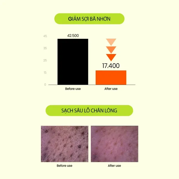sua-rua-mat-beplain-dau-xanh-can-bang-do-ph-mung-bean-ph-balanced-cleansing-foam-160ml-6