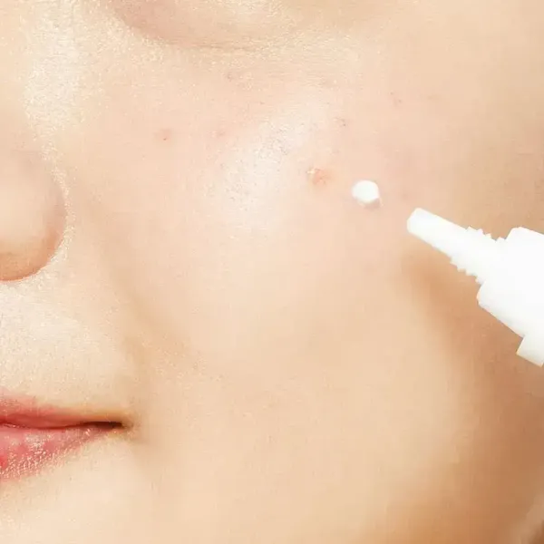kem-duong-da-mat-cosrx-ac-collection-ultimate-spot-cream-2