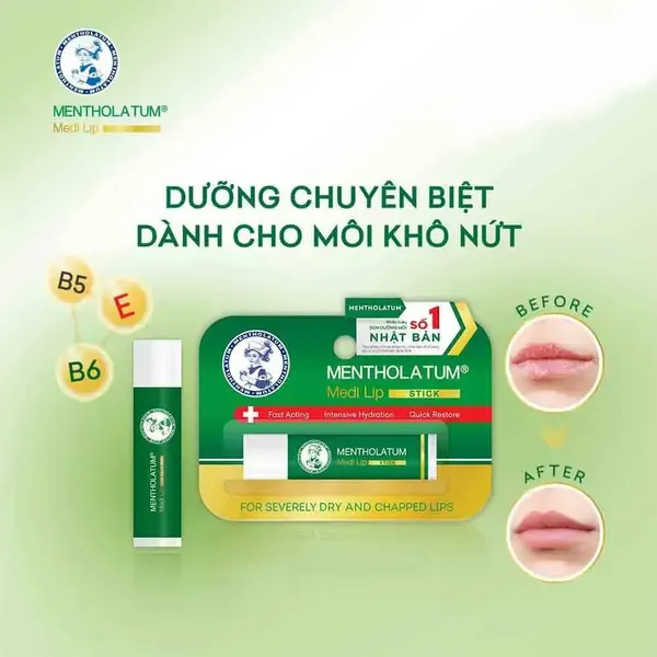 son-duong-moi-mentholatum-medi-lip-stick-4-3g-4